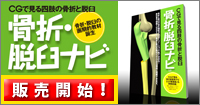 CGで見る骨折と脱臼 骨折･脱臼ナビ1.0