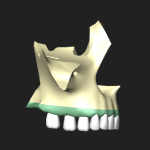 歯槽弓（上顎骨）