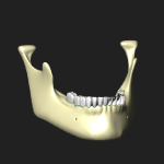 歯槽（下顎骨）