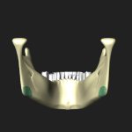 歯槽弓（下顎骨）